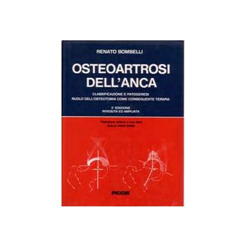 Osteoartrosi dell'anca 2/ed.