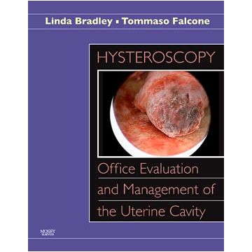 Hysteroscopy: Office Evaluation and Management of the Uterine Cavity -Text with DVD-ROM