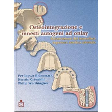 Osteointegrazione e innesti autogeni ad onlay - Ricostruzione del mascellare superiore atrofico edentulo