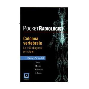 POCKET RADIOLOGIST - Colonna Vertebrale - Le 100 Diagnosi Principali