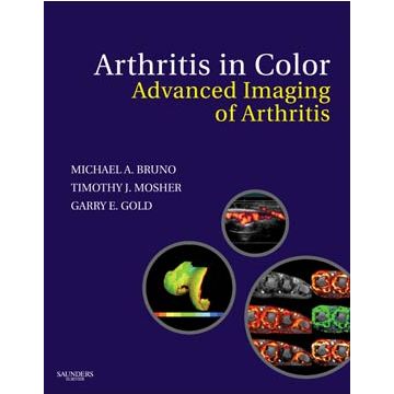 Arthritis in Color - Advanced Imaging of Arthritis