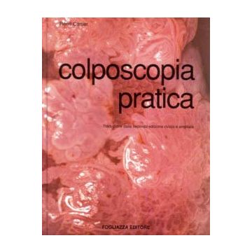 Colposcopia pratica