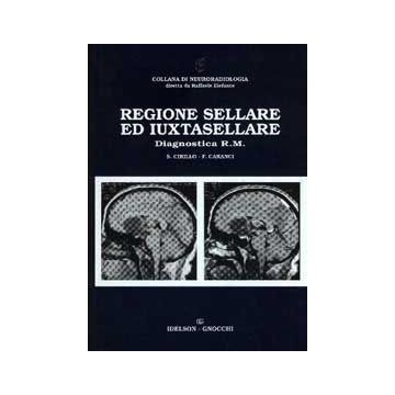 Regione sellare e iuxtasellare - Diagnostica RM (Risonanza Magnetica)