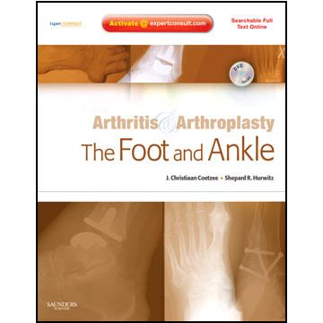 Arthritis and Arthroplasty: The Foot and Ankle - Expert Consult - Online, Print and DVD