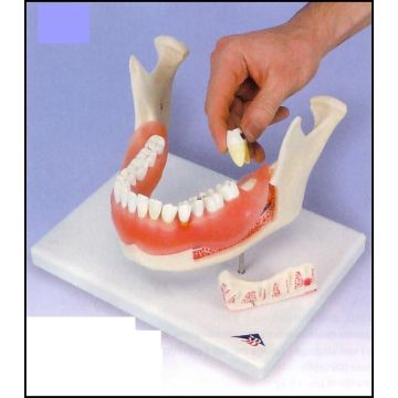 Patologie dentali, ingrandito 2 volte, 21 pezzi