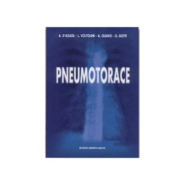 Pneumotorace
