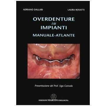 Overdenture su impianti - Manuale atlante  [Dallari; Rovatti - Martina Edizioni]