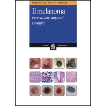 IL MELANOMA Prevenzione Diagnosi Terapia