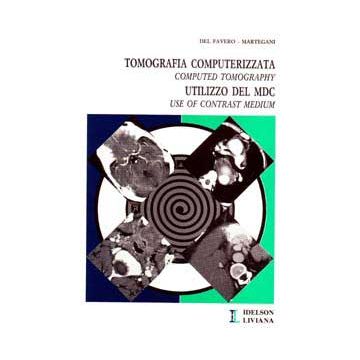 Tomografia computerizzata. Utilizzo del mdc. Computed tomography. Use of contrast medium