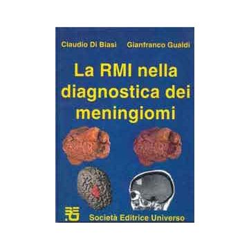 LA RMI NELLA DIAGNOSTICA DEI MENINGIOMI