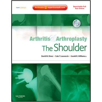 Arthritis and Arthroplasty: The Shoulder - Expert Consult - Online, Print and DVD