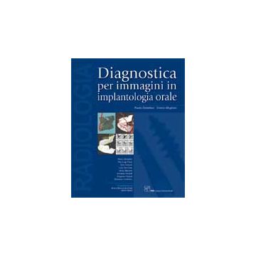 Diagnostica per Immagini in Implantologia Orale