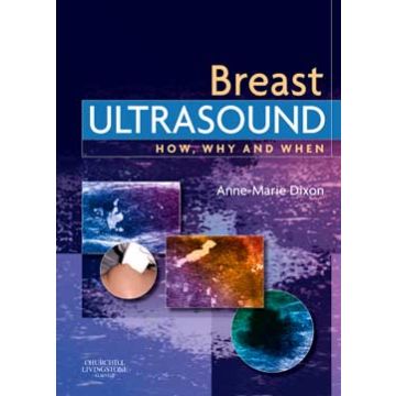 Breast Ultrasound -How, Why and When