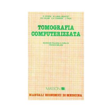 Tomografia computerizzata