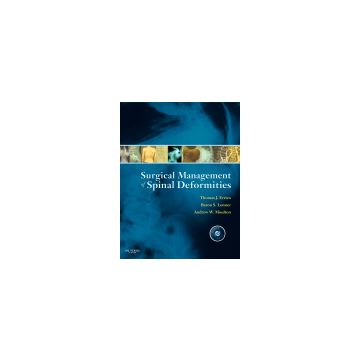 Surgical Management of Spinal Deformities - Expert Consult: Online and Print