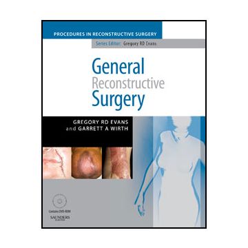 General Reconstructive Surgery with DVD  -A Volume in the Procedures in Reconstructive Surgery Series