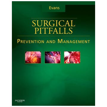 Surgical Pitfalls - Prevention and Management