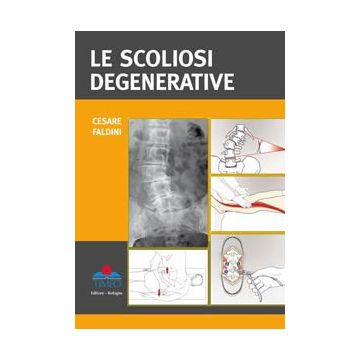 Le Scoliosi Degenerative  [Faldini - Timeo Editore]