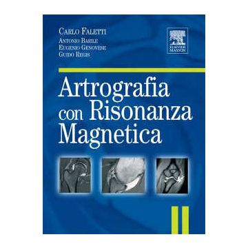 Artrografia con Risonanza Magnetica RM