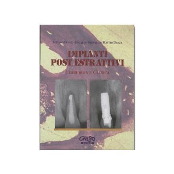 Impianti post-estrattivi. Chirurgia e clinica