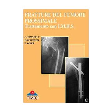 Fratture del Femore Prossimale: Trattamento con I.M.H.S.   [Fancellu - Timeo Editore]