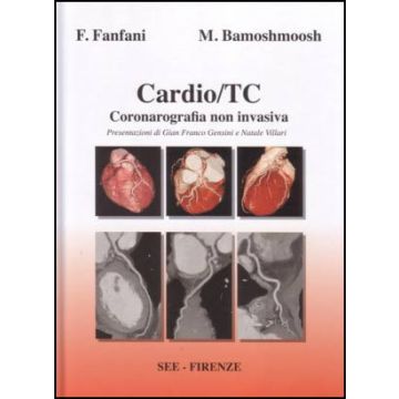 Cardio / TC - Coronarografia non invasiva