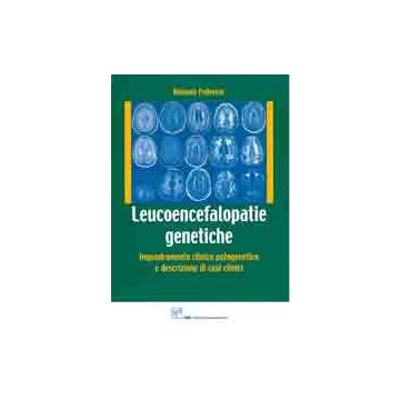 Leucoencefalopatie Genetiche. Inquadramento clinico patogenetico e descrizione di casi clinici