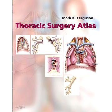 Thoracic Surgery Atlas