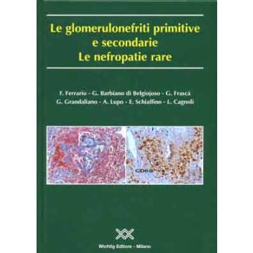 Le Glomerulonefriti primitive e secondarie. Le Nefropatie rare