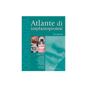 Atlante di Implantoprotesi