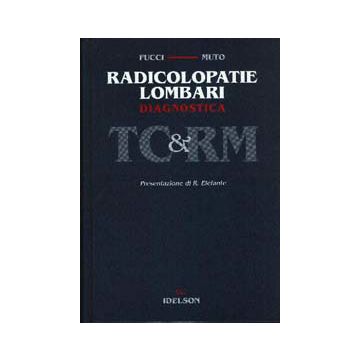 Radicolopatie lombari. Diagnostica TC e RM