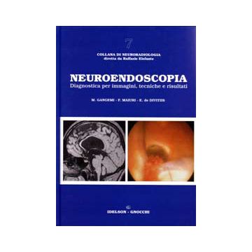 Neuroendoscopia