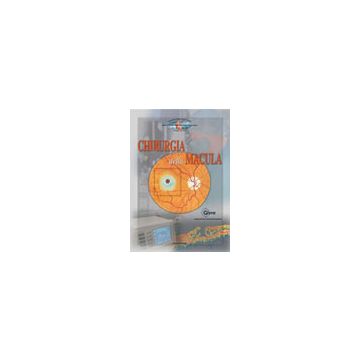 La chirurgia della macula - Rapporto SOI 2001