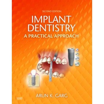 Implant Dentistry, 2nd Edition - A Practical Approach