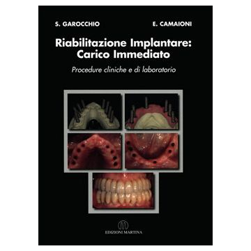 Riabilitazione Implantare: Carico Immediato - Procedure cliniche e di laboratorio