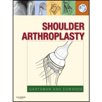 Shoulder Arthroplasty