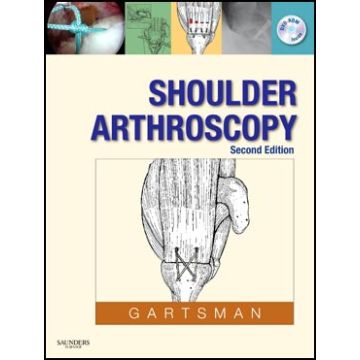 Shoulder Arthroscopy, 2nd Edition