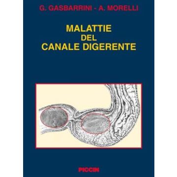 Malattie del canale digerente