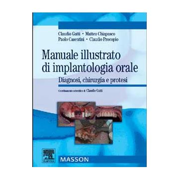 Manuale illustrato di implantologia orale. Diagnosi, Chirurgia e Protesi [Gatti; Chiapasco - Elsevier Masson]  (POD)