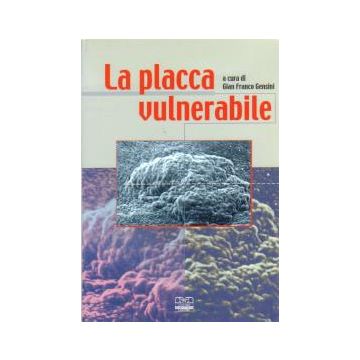 La Placca Vulnerabile