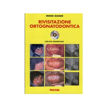 Rivisitazione ortognatodontica + DVD