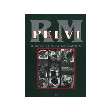 RM Pelvi (Risonanza Magnetica) Giovagnoni Andrea Idelson Gnocchi