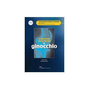 La revisione delle protesi di Ginocchio