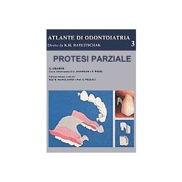 Protesi Parziale