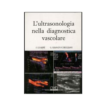 Ultrasonologia nella diagnostica vascolare