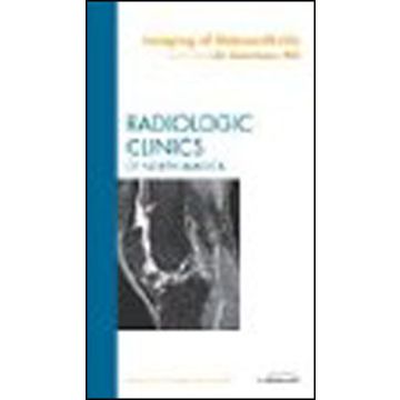 Imaging of Osteoarthritis, An Issue of Radiologic Clinics of North America Volume 47-4