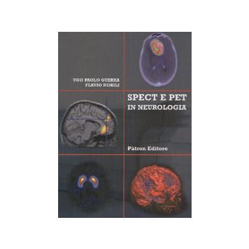Spect e Pet in Neurologia (Positron Emission Tomography)