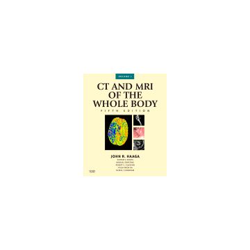 CT and MRI of the Whole Body, 2-Volume Set, 5th Edition