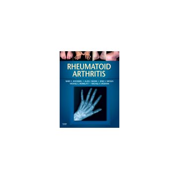 Rheumatoid Arthritis