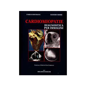 Cardiomiopatie diagnostica per immagini